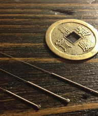 Book an Appointment with Shant Baboujian for Community Acupuncture